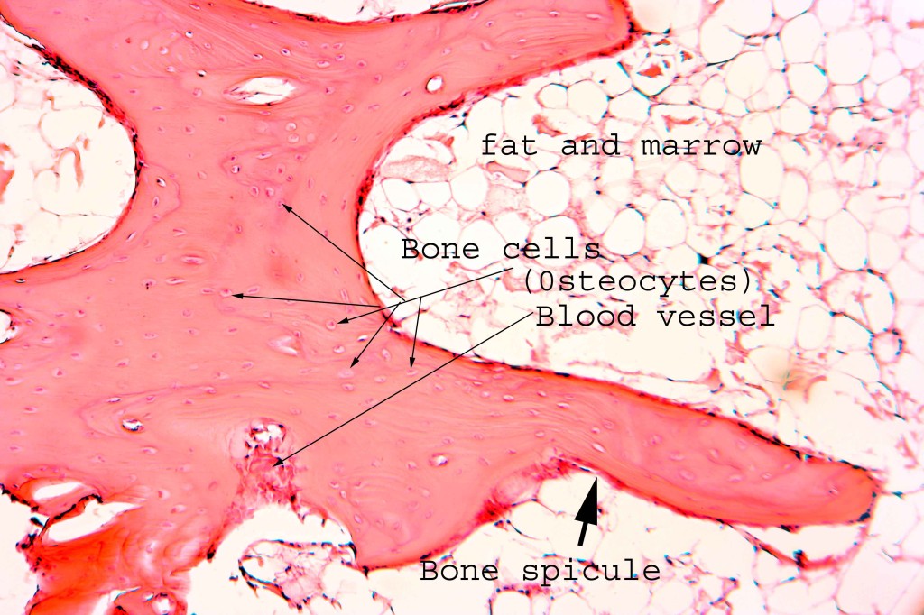 For comparison, here is a histological specimen of rabbit bone, The bone in this slide is reed and again the lacunae are well seen. The fat and marrow are seen on the right of the slide.